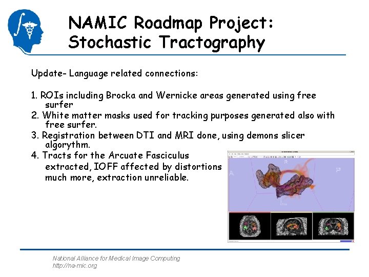 NAMIC Roadmap Project: Stochastic Tractography Update- Language related connections: 1. ROIs including Brocka and