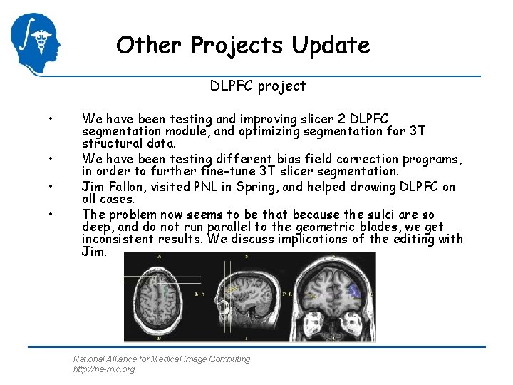 Other Projects Update DLPFC project • • We have been testing and improving slicer