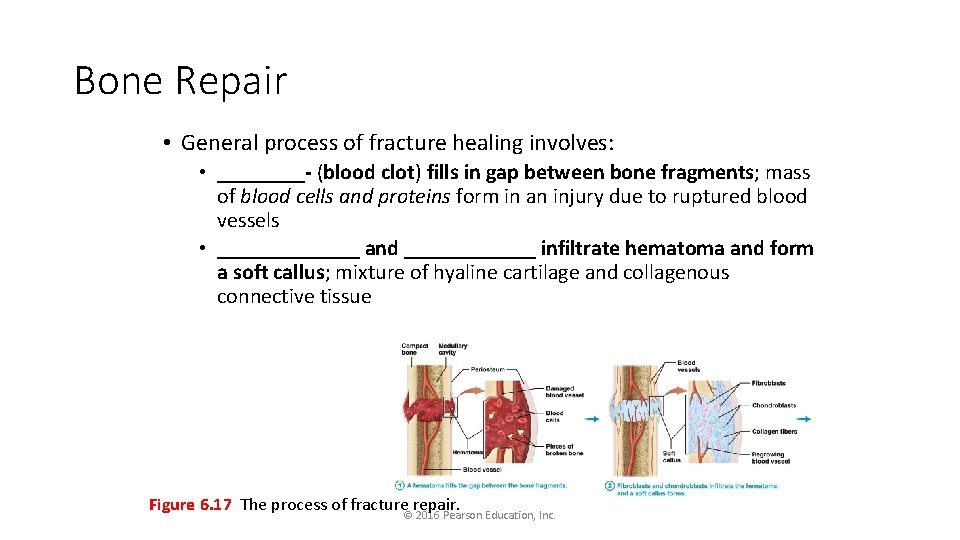 Bone Repair • General process of fracture healing involves: • ____- (blood clot) fills