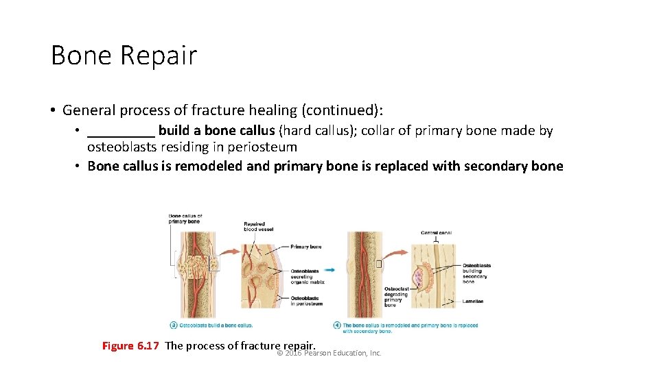 Bone Repair • General process of fracture healing (continued): • _____ build a bone