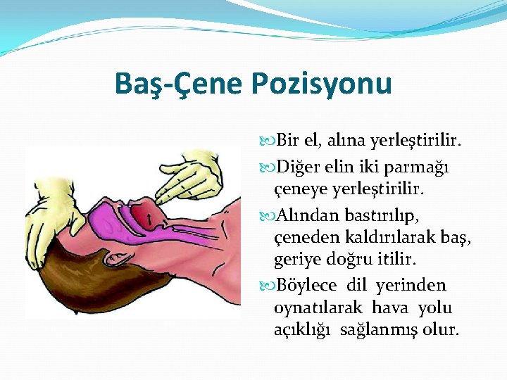 Baş-Çene Pozisyonu Bir el, alına yerleştirilir. Diğer elin iki parmağı çeneye yerleştirilir. Alından bastırılıp,