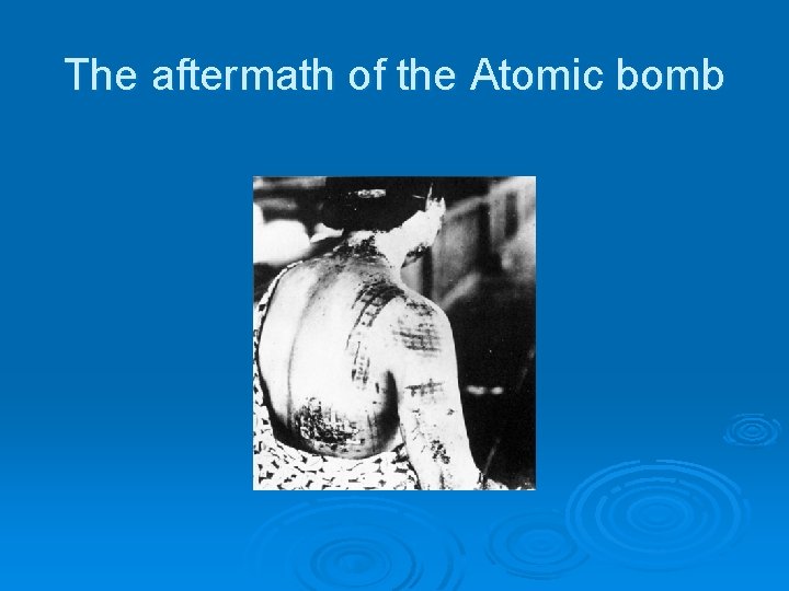 The aftermath of the Atomic bomb 