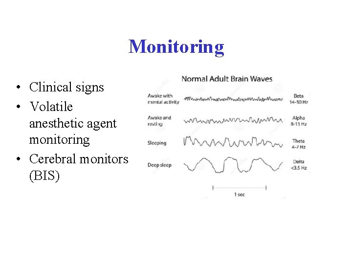 Monitoring • Clinical signs • Volatile anesthetic agent monitoring • Cerebral monitors (BIS) 