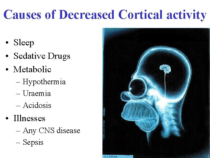Causes of Decreased Cortical activity • Sleep • Sedative Drugs • Metabolic – Hypothermia