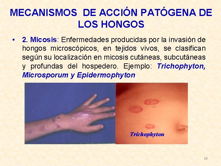 MECANISMOS DE ACCIÓN PATÓGENA DE LOS HONGOS • 2. Micosis: Enfermedades producidas por la