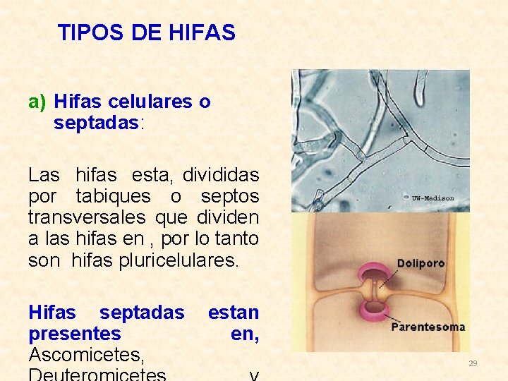 TIPOS DE HIFAS a) Hifas celulares o septadas: Las hifas esta, divididas por tabiques
