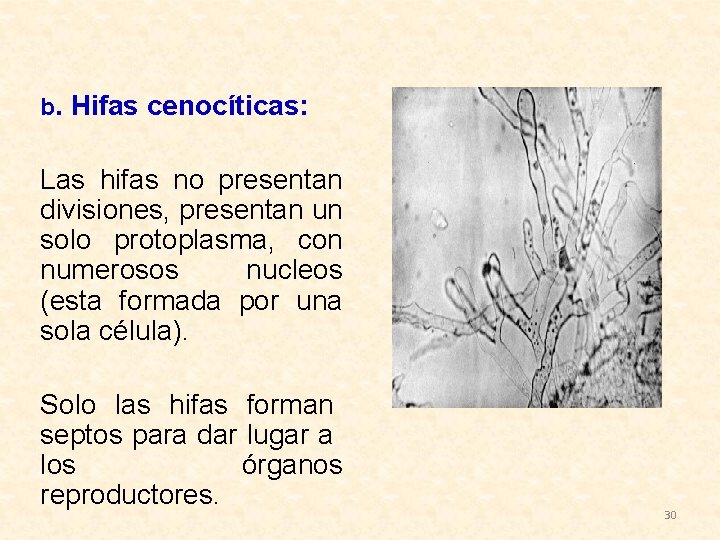 b. Hifas cenocíticas: Las hifas no presentan divisiones, presentan un solo protoplasma, con numerosos