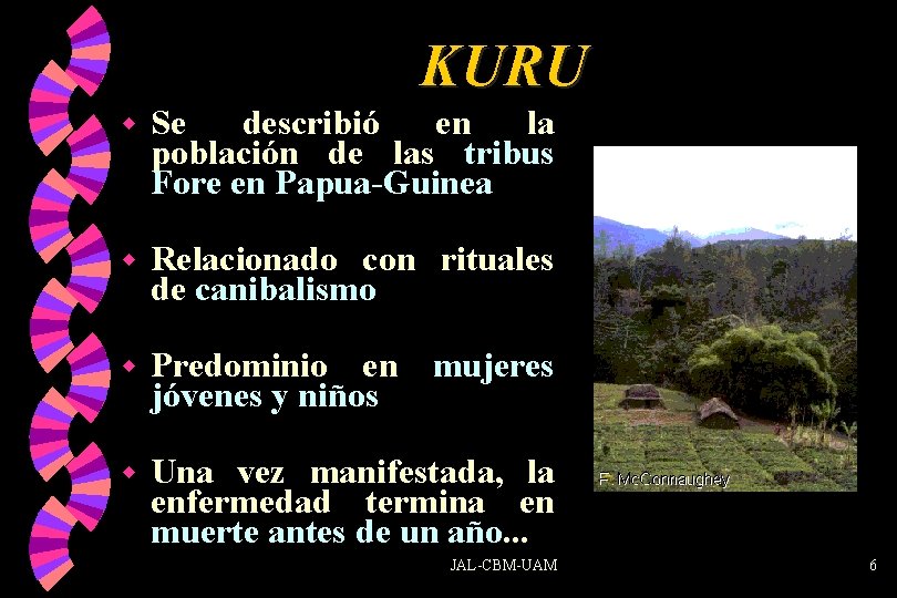 KURU w Se describió en la población de las tribus Fore en Papua-Guinea w