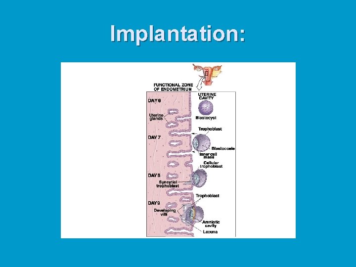 Implantation: 