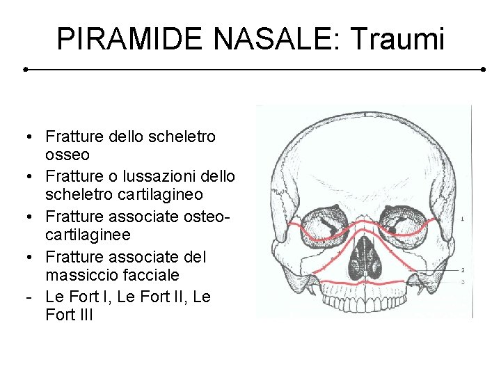 PIRAMIDE NASALE: Traumi • Fratture dello scheletro osseo • Fratture o lussazioni dello scheletro