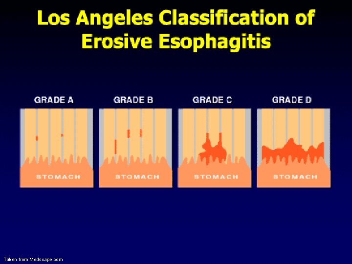 Taken from Medscape. com 