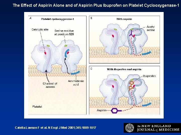 The Effect of Aspirin Alone and of Aspirin Plus Ibuprofen on Platelet Cyclooxygenase-1 Catella-Lawson