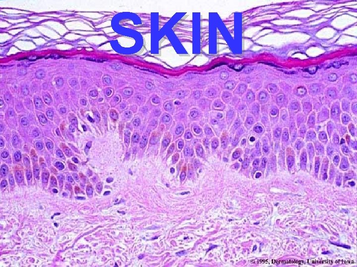 SKIN 