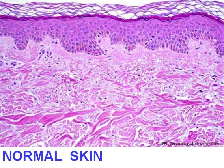 NORMAL SKIN 