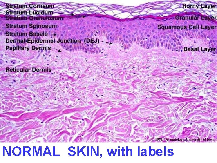 NORMAL SKIN, with labels 