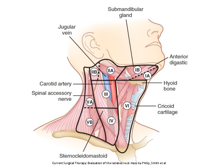 Current Surgical Therapy: Evaluation of the isolated neck mass by Philip, Smith et al
