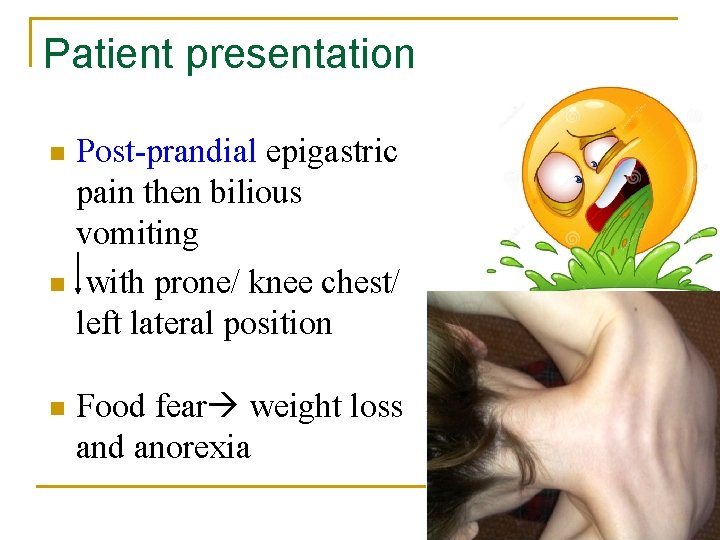 Patient presentation Post-prandial epigastric pain then bilious vomiting n with prone/ knee chest/ left Patient presentation Post-prandial epigastric pain then bilious vomiting n with prone/ knee chest/ left