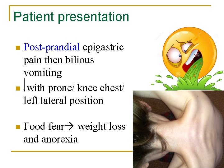 Patient presentation Post-prandial epigastric pain then bilious vomiting n with prone/ knee chest/ left