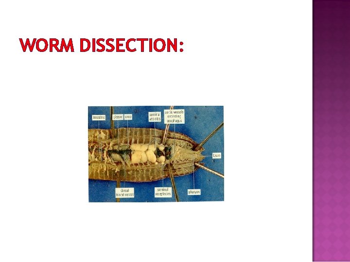 WORM DISSECTION: 