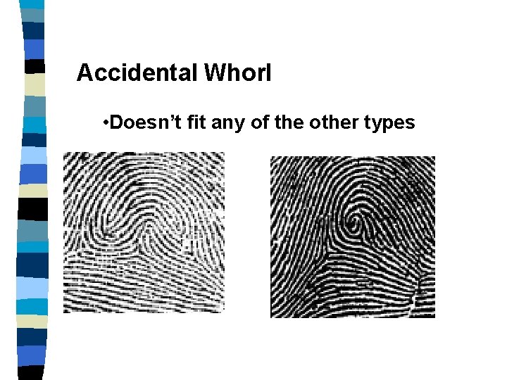Accidental Whorl • Doesn’t fit any of the other types 