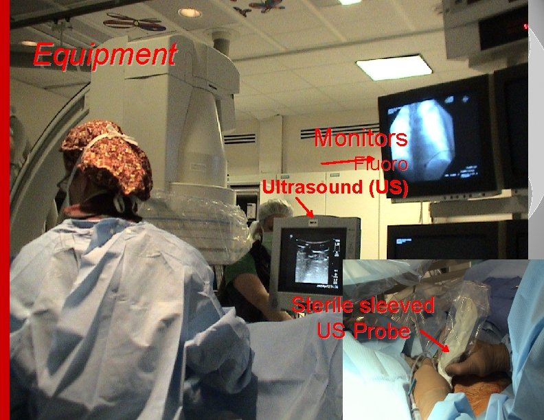 Equipment Monitors Fluoro Ultrasound (US) Sterile sleeved US Probe 