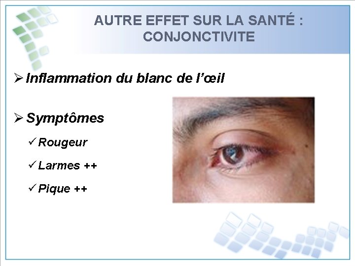 AUTRE EFFET SUR LA SANTÉ : CONJONCTIVITE Ø Inflammation du blanc de l’œil Ø