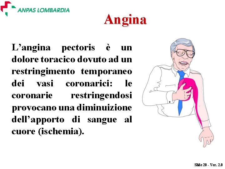 Angina L’angina pectoris è un dolore toracico dovuto ad un restringimento temporaneo dei vasi Angina L’angina pectoris è un dolore toracico dovuto ad un restringimento temporaneo dei vasi