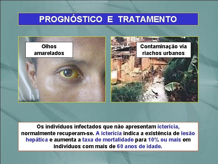PROGNÓSTICO E TRATAMENTO Olhos amarelados Contaminação via riachos urbanos Os indivíduos infectados que não