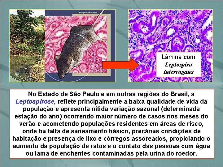 Lâmina com Leptospira interrogans No Estado de São Paulo e em outras regiões do