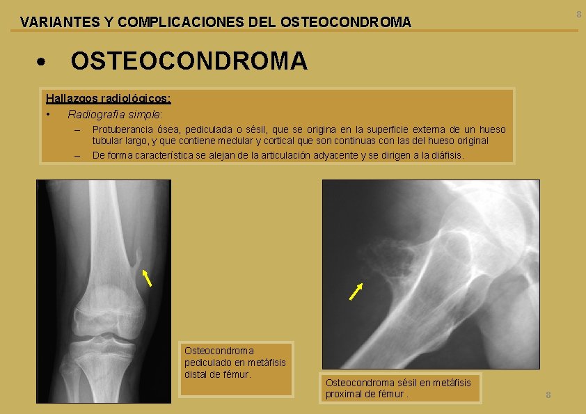 8 VARIANTES Y COMPLICACIONES DEL OSTEOCONDROMA • OSTEOCONDROMA Hallazgos radiológicos: • Radiografía simple: –