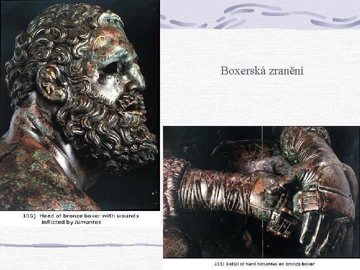 Boxerská zranění Boxerská zranění