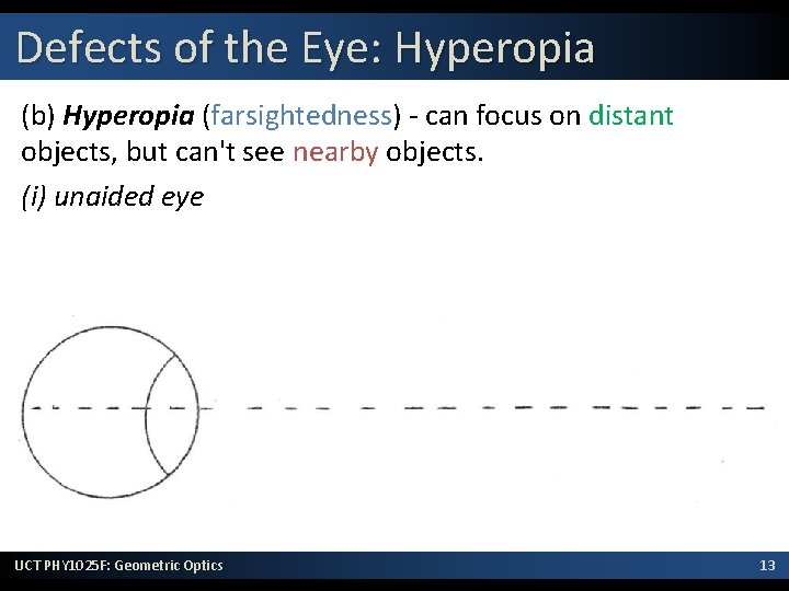 Defects of the Eye: Hyperopia (b) Hyperopia (farsightedness) - can focus on distant objects,