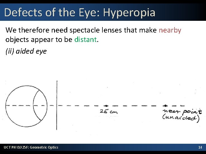 Defects of the Eye: Hyperopia We therefore need spectacle lenses that make nearby objects