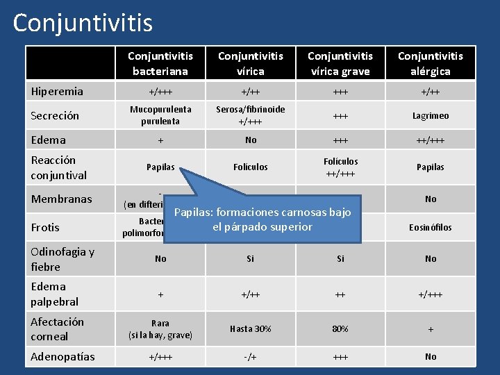 Conjuntivitis bacteriana Conjuntivitis vírica grave Conjuntivitis alérgica Hiperemia +/+++ +/++ Secreción Mucopurulenta Serosa/fibrinoide +/+++