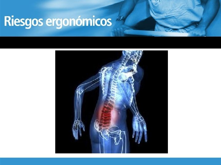 Riesgo Ergonómico 