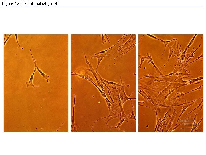 Figure 12. 15 x Fibroblast growth 