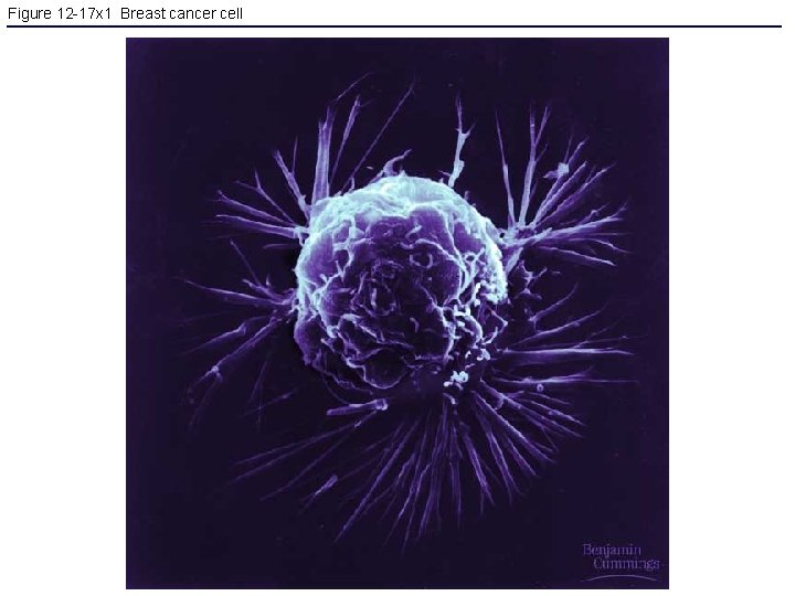 Figure 12 -17 x 1 Breast cancer cell 