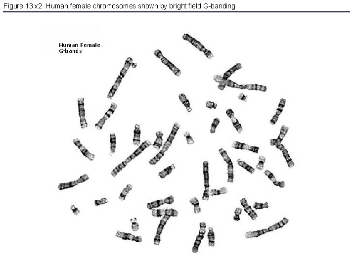 Figure 13. x 2 Human female chromosomes shown by bright field G-banding 