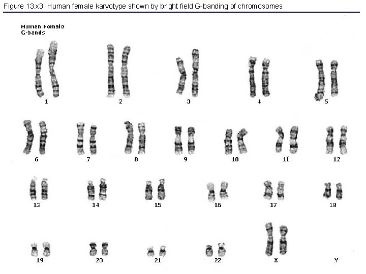 Figure 13. x 3 Human female karyotype shown by bright field G-banding of chromosomes