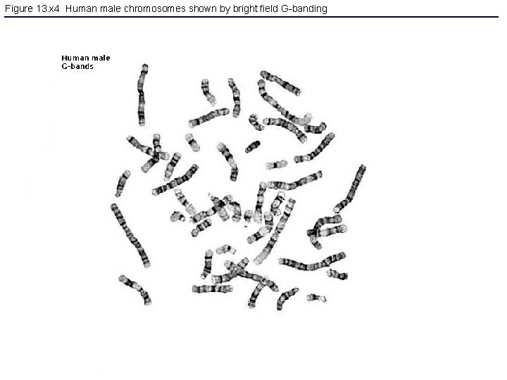 Figure 13. x 4 Human male chromosomes shown by bright field G-banding 