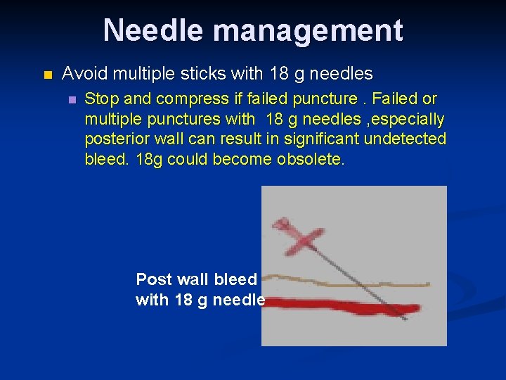 Needle management n Avoid multiple sticks with 18 g needles n Stop and compress