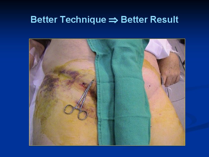 Better Technique Better Result 