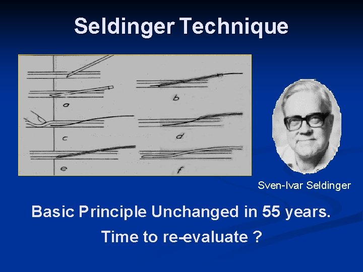 Seldinger Technique Sven-Ivar Seldinger Basic Principle Unchanged in 55 years. Time to re-evaluate ?