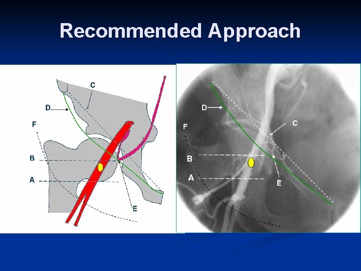 Recommended Approach 