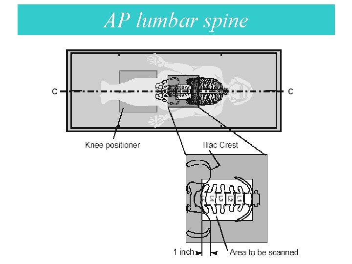 AP lumbar spine 