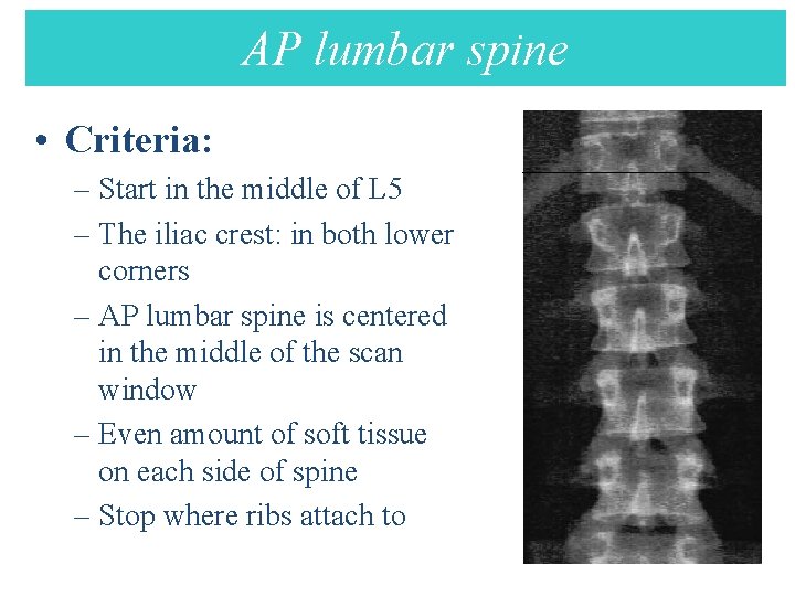 AP lumbar spine AP Lumbar spine • Criteria: – Start in the middle of