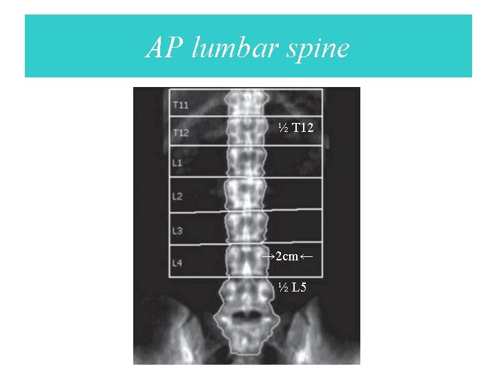 AP lumbar spine ½ T 12 → 2 cm← ½ L 5 