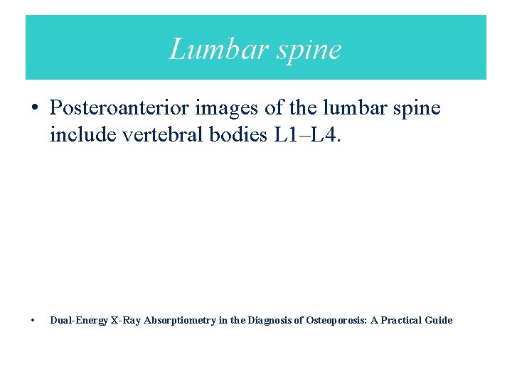 Lumbar spine • Posteroanterior images of the lumbar spine include vertebral bodies L 1–L