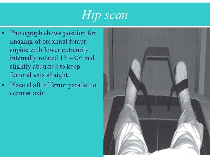 Hip scan • Photograph shows position for imaging of proximal femur: supine with lower