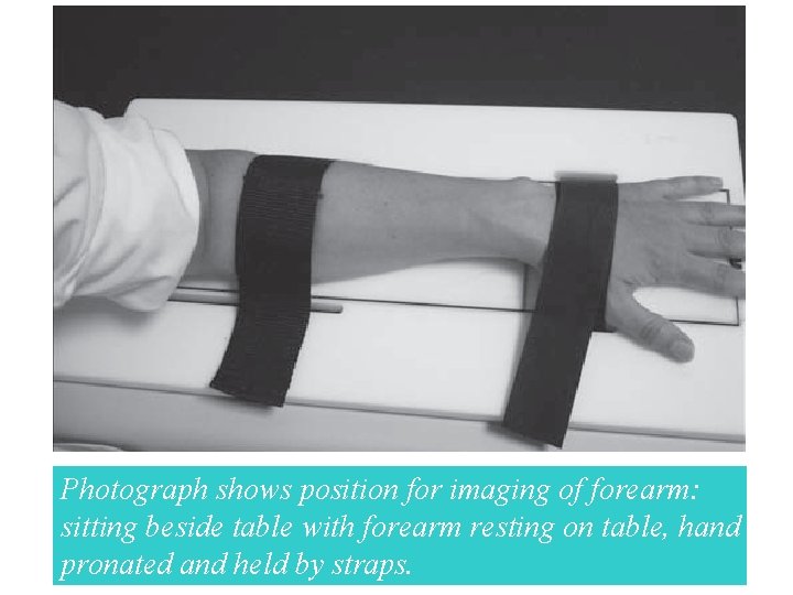 Photograph shows position for imaging of forearm: sitting beside table with forearm resting on
